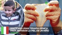 Terapia génica: Niño con rara enfermedad es salvado con piel cultivada en terapia génica - TomoNews