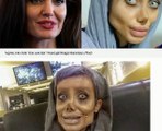 Iraniana se submete a 50 cirurgias plásticas para ficar parecida com Angelina Jolie