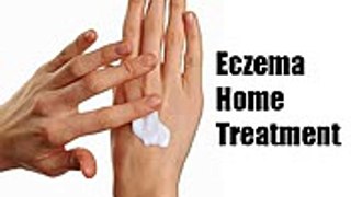Eczema Home Treatments  6 Killer Natural Treatments for Eczema