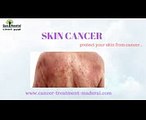 Skin Cancer Treatment in Tamil Nadu  Cancer Treatment Hospital in Madurai