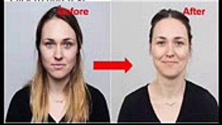 How To Look 10 Years Younger in 4 Weeks! Get Young And Glowing Skin Naturally