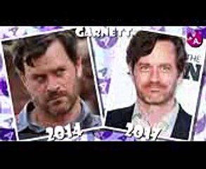 Z NATION BEFORE AND AFTER 2017 (Z NATION TELEVISION SERIES CAST)