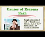 Eczema Rash - Eczema Rashes - Eczema Rash Treatment - Eczema Rash on Face - Eczema Rash on Foreskin