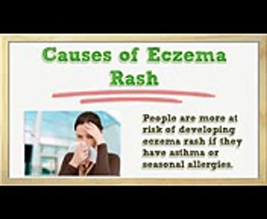 Eczema Rash - Eczema Rashes - Eczema Rash Treatment - Eczema Rash on Face - Eczema Rash on Foreskin
