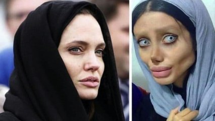 Pour ressembler à Angelina Jolie, cette jeune fille a subi 50 opérations de chirurgie esthétique...