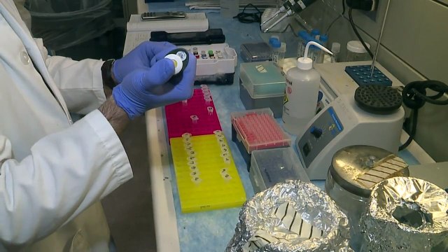 Doctor Researching Breast Cancer Vaccine Receives Grant