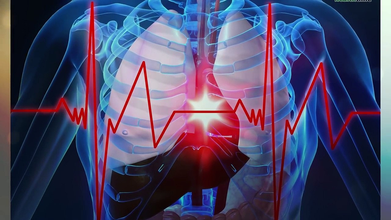अचानक हार्ट अटैक आने पर तुरंत करें ये काम #Heart Attack # Health Tips #Health Time