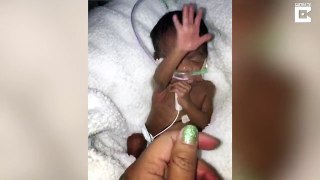 Not now mum: Sassy premie baby palms off mum’s affection despite being born at just five months