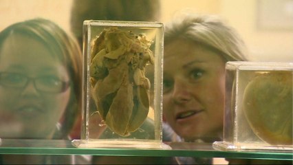 50 years after first successful human heart transplant