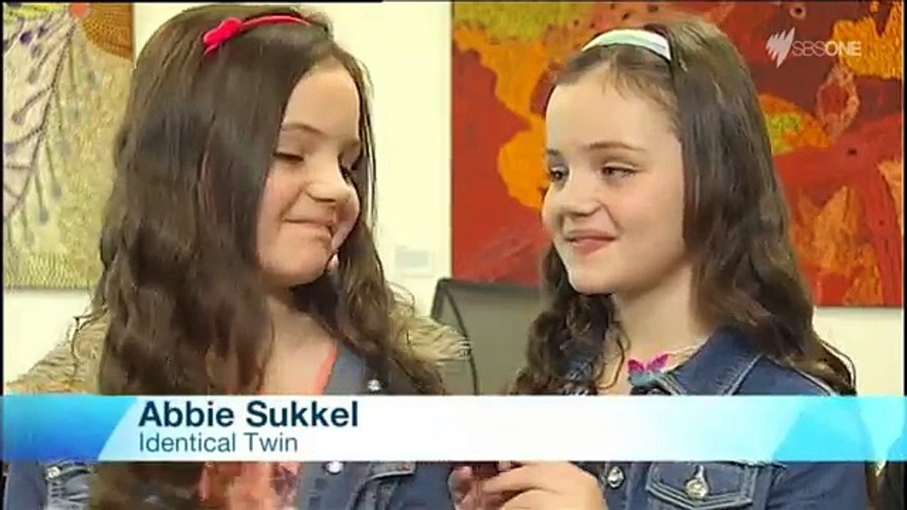 One third of twins dont know they are identical   World News Australia   SBS On Demand-8dss8xi_LCQ