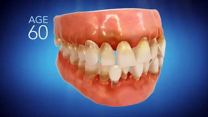 Invisalign Dentist Warner Robins GA