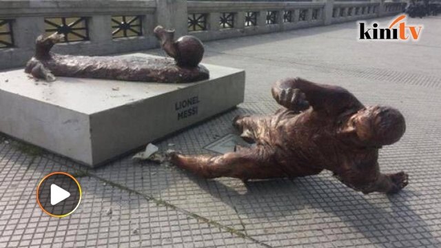 Kaki 'Messi' patah lagi