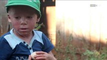 Glyphosat - Argentiniens kranke Kinder