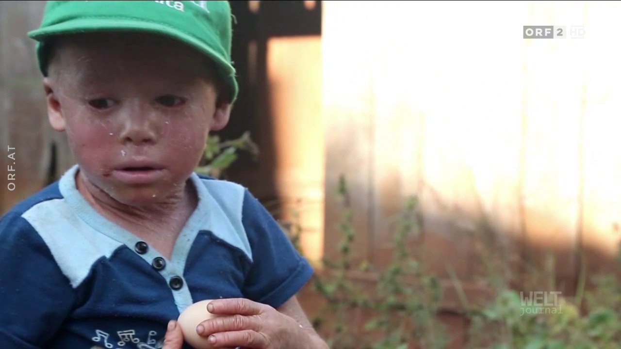 Glyphosat - Argentiniens kranke Kinder