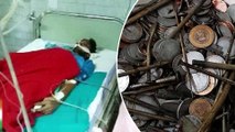 Pria India makan paku dan koin, dokter temukan 263 koin dan 100 paku dalam perut - TomoNews