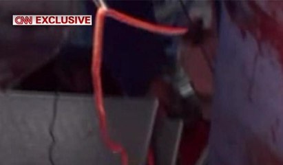 Kuzey Koreli askerin içinden çıkan 27 santimlik parazit!