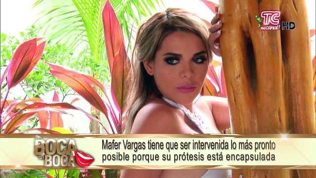 La modelo María Fernanda Vargas tiene fuertes dolores en una de sus prótesis