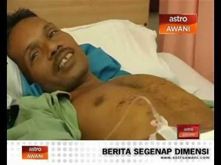 Lelaki cedera tekena mercun
