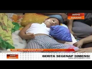 Anak lumpuh seumur hidup