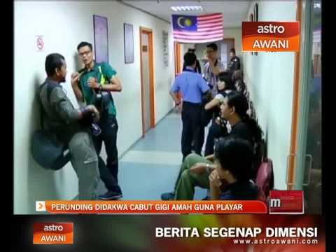 Perunding didakwa cabut gigi amah guna playar