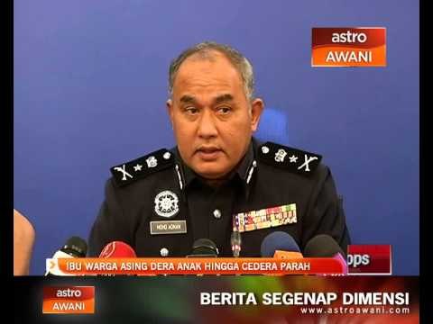 Ibu warga asing dera anak hingga cedera parah