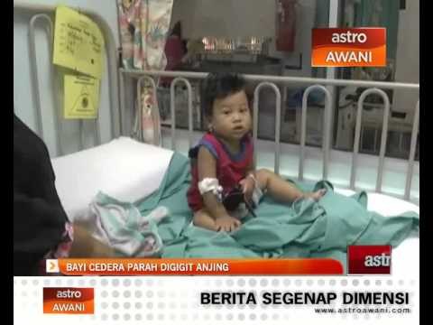 Bayi cedera parah digigit anjing