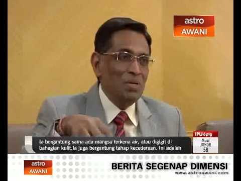 Tiada rakyat Malaysia positif dijangkiti rabies