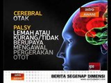 Apa itu Cerebral Palsy?