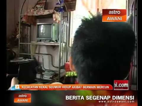 Kecacatan kekal akibat mercun ganggu kehidupan