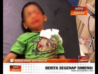 Hancur jari tangan kiri akibat main mercun