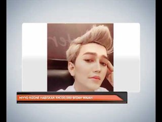 Miyyo Rizone habiskan RM200,000 bedah wajah