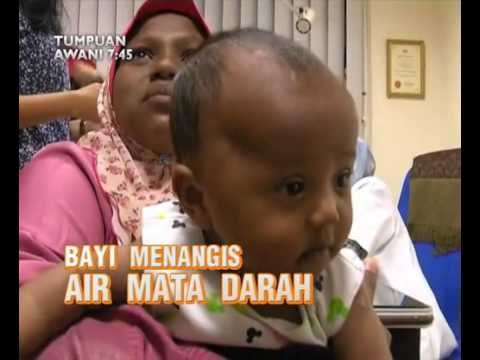 AWANI 7:45 - Bayi menangis air mata darah & penuntut IPTA tumpu kepada pembelajaran