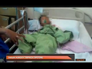 Tangan mungkin terpaksa dipotong