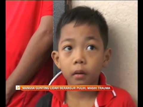 Mangsa gunting lidah beransur pulih, masih trauma