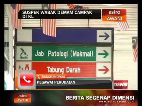 Kementerian Kesihatan siasat penularan demam campak