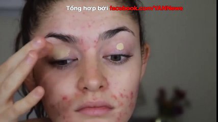 Màn makeup 'thách thức mụn' của người đẹp
