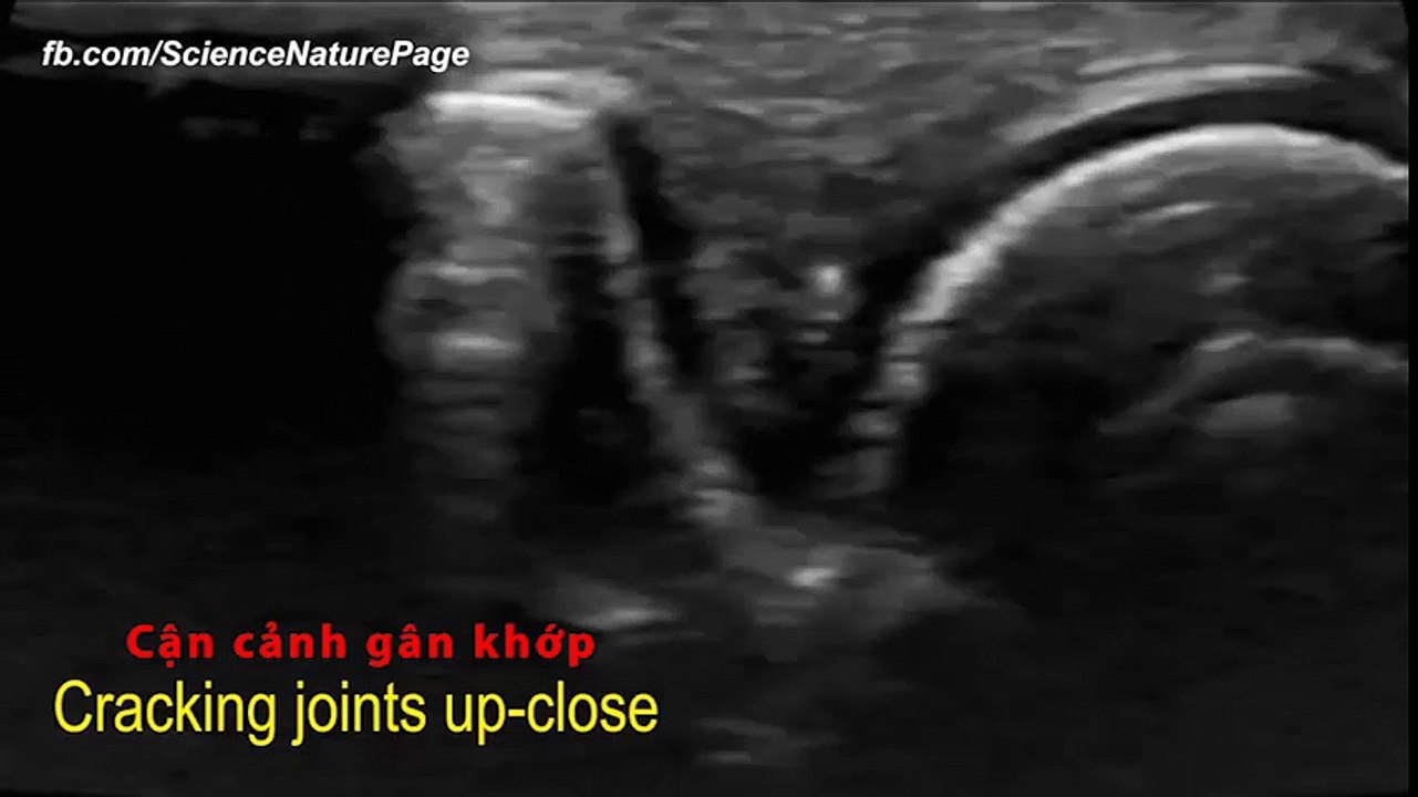 xem tận mắt hoạt động bên trong cơ thể người nhờ công nghệ quay Xquang