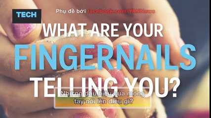 Những dấu hiệu của móng tay nói lên điều gì