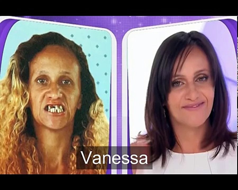 TOP 10 As transformações incríveis do Beleza Renovada