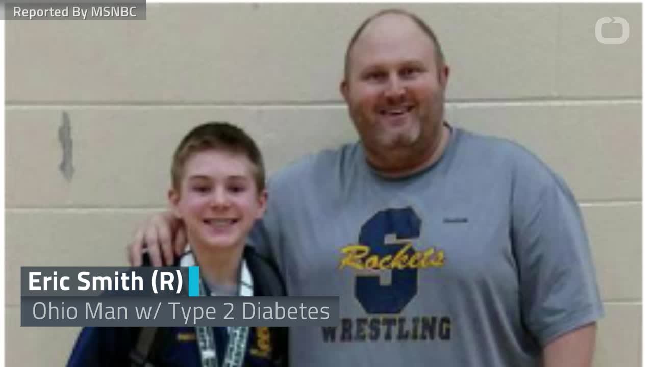 Can Weight Loss Control Type 2 Diabetes