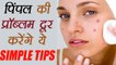 Pimples: ये टिप्स मुहांसों से दिलाऐंगे छुटकारा | Tips to get rid of Pimples | Boldsky