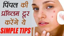 Pimples: ये टिप्स मुहांसों से दिलाऐंगे छुटकारा | Tips to get rid of Pimples | Boldsky