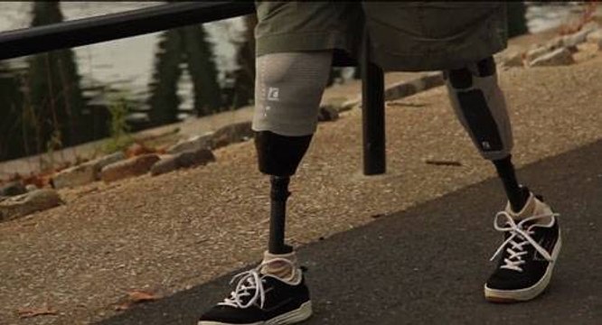 Como as próteses digitais podem ajudar atletas e pessoas com restrições motoras