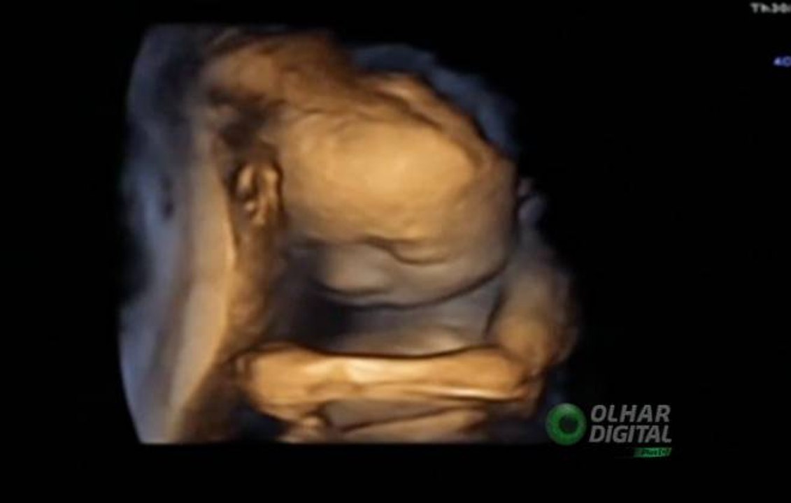 Impressão em 3D é revolução para ultrassom