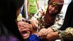 Wabah difteri berbahaya merebak di 20 provinsi seluruh Indonesia - TomoNews