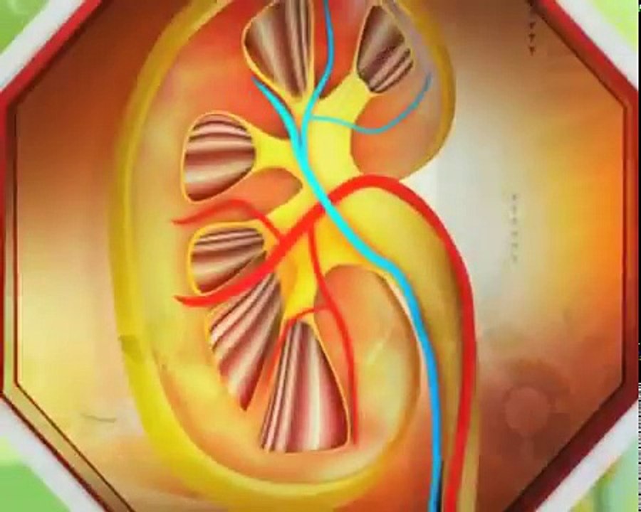Best Ayurvedic Treatment For Proteinuria -- Ayurvedic Kidney Treatment Through Dr. Puneet Dhawan At karma Ayurveda