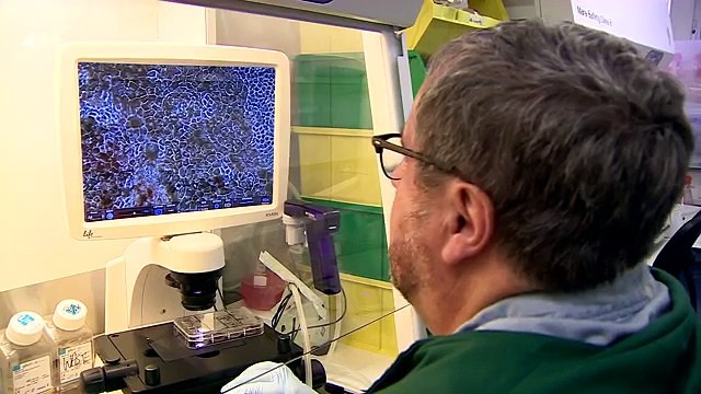 Stem cell cure for blindness tested - BBC News