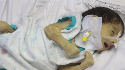 غارات النظام تستهدف المرافق الطبية بالغوطة الشرقية