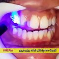 Dental Orthodontics in Dental Clinic