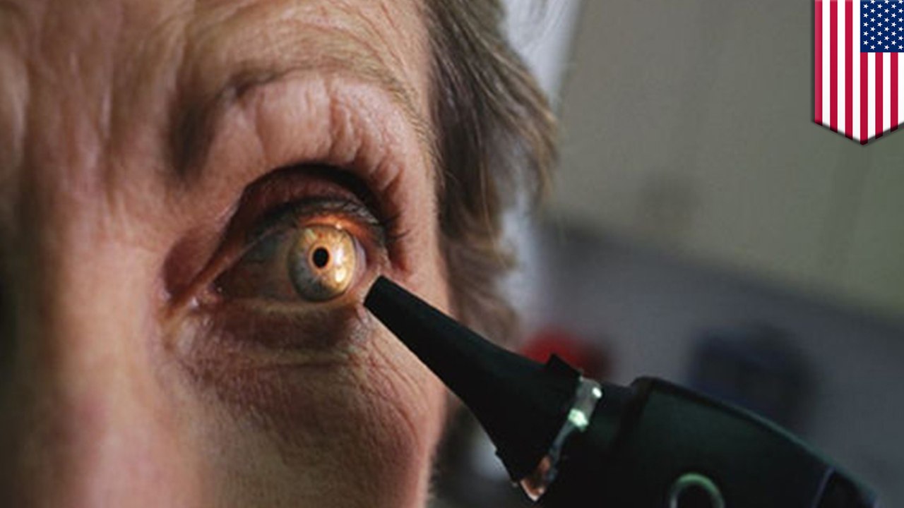 Woman gets crescent-shaped eye damage from staring at eclipse